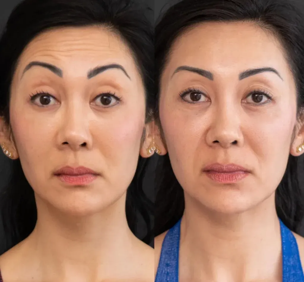 Patrícia Antes e Depois